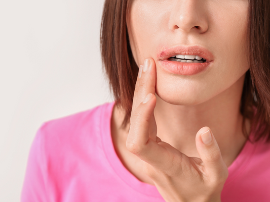 Sådan ved du, om du har herpes: Tegn og symptomer